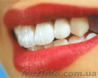 Зубные мосты (протезирование зубов) в Харькове - <ro>Изображение</ro><ru>Изображение</ru> #1, <ru>Объявление</ru> #428267
