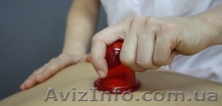 Массаж банками Мед.центр на м. Советская Выезд на дом - <ro>Изображение</ro><ru>Изображение</ru> #1, <ru>Объявление</ru> #480614