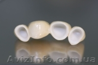 Коронки на оксиде циркония и алюминия — Харьков - <ro>Изображение</ro><ru>Изображение</ru> #1, <ru>Объявление</ru> #465151