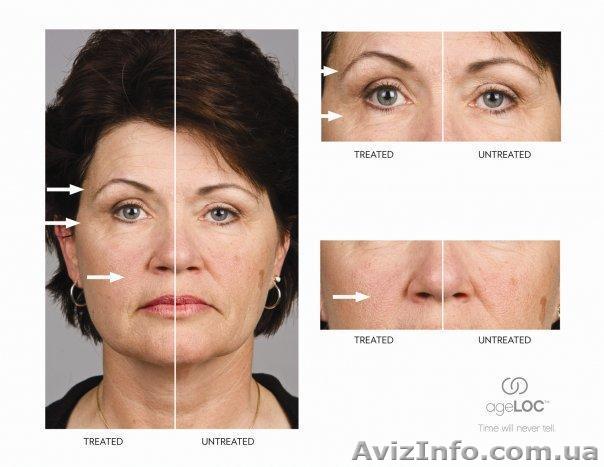 Микротоки , миостимуляция - <ro>Изображение</ro><ru>Изображение</ru> #1, <ru>Объявление</ru> #552779