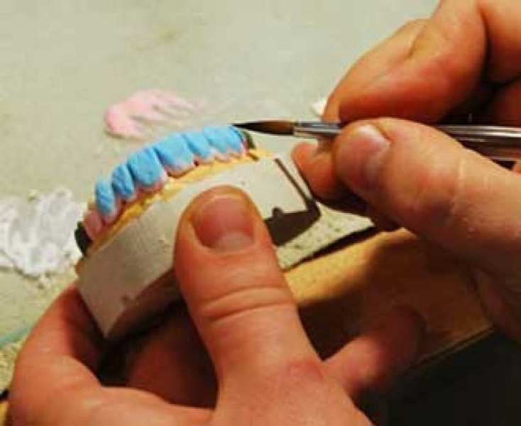 Требуется зубной техник-гипсовщик - <ro>Изображение</ro><ru>Изображение</ru> #1, <ru>Объявление</ru> #1663195