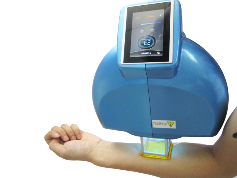 Витилиго - <ro>Изображение</ro><ru>Изображение</ru> #1, <ru>Объявление</ru> #1674588