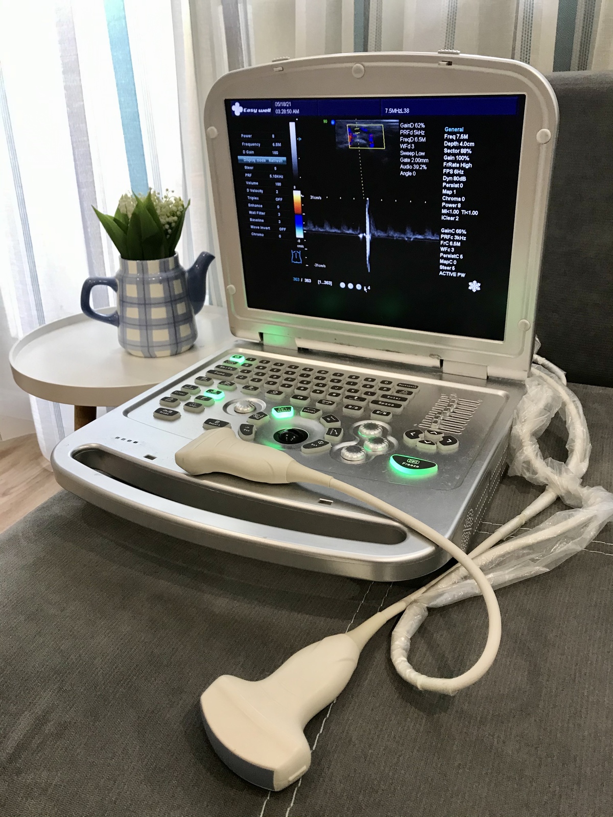 УЗИ на дому у больного в Харькове. - <ro>Изображение</ro><ru>Изображение</ru> #1, <ru>Объявление</ru> #1708501