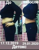 ХУДЕЕМ ЛЕГКО - <ro>Изображение</ro><ru>Изображение</ru> #5, <ru>Объявление</ru> #1675700