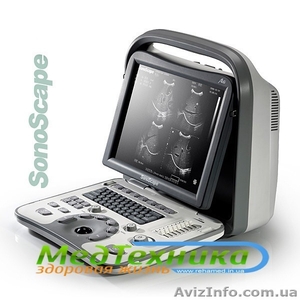 Черно-белый узи сканер SonoScape A6 - <ro>Изображение</ro><ru>Изображение</ru> #1, <ru>Объявление</ru> #944776