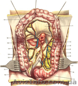 Атлас операций на брюшной стенке и органах брюшной полости В.Н.   Войл - <ro>Изображение</ro><ru>Изображение</ru> #1, <ru>Объявление</ru> #1139855