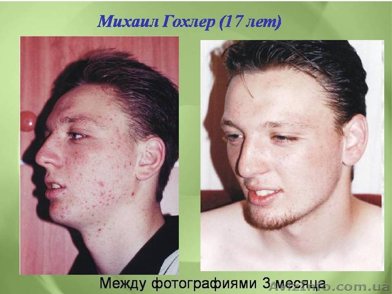 Центр коррекции веса и самочувствия - <ro>Изображение</ro><ru>Изображение</ru> #3, <ru>Объявление</ru> #566698