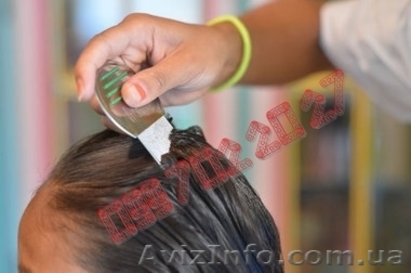 Nit Free с частым гребнем для полного уничтожения гнид и вшей - <ro>Изображение</ro><ru>Изображение</ru> #3, <ru>Объявление</ru> #1030915