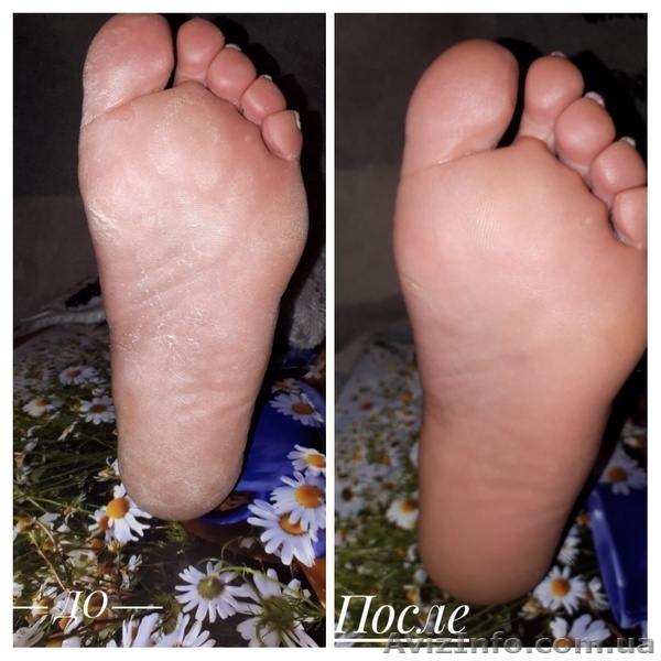 Наращивание ногтей. Покрытие гель лаком c выравниванием.Салтовка - <ro>Изображение</ro><ru>Изображение</ru> #4, <ru>Объявление</ru> #1035960