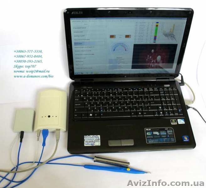 Диагностический прибор врачам Паркес-Д - <ro>Изображение</ro><ru>Изображение</ru> #3, <ru>Объявление</ru> #1618590