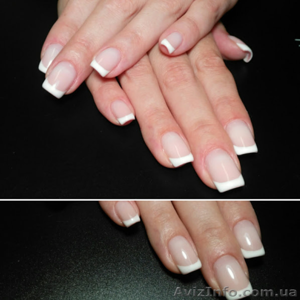 В кабинет закрытого типа приглашаю на медицинский аппаратный педикюр, Харьков - <ro>Изображение</ro><ru>Изображение</ru> #2, <ru>Объявление</ru> #1633708